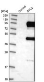 Anti-DVL2 antibody produced in rabbit Prestige Antibodies® Powered by Atlas Antibodies, affinity isolated antibody, buffered aqueous glycerol solution