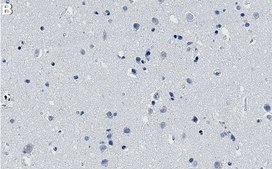 Anti-ROCK2 Antibody, clone 1B20 ZooMAb® Rabbit Monoclonal recombinant, expressed in HEK 293 cells