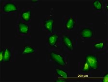 Monoclonal Anti-G3BP antibody produced in mouse clone 2F3, purified immunoglobulin, buffered aqueous solution