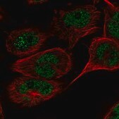 Anti-TAF8 antibody produced in rabbit Prestige Antibodies® Powered by Atlas Antibodies, affinity isolated antibody, buffered aqueous glycerol solution