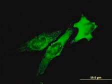 Monoclonal Anti-TSG101 antibody produced in mouse clone 5B7, purified immunoglobulin, buffered aqueous solution