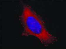 抗 纽蛋白抗体，小鼠单克隆 clone V284, purified from hybridoma cell culture