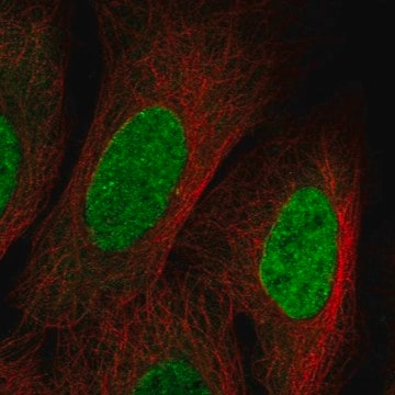 Anti-Kmt5C Antibody Produced In Rabbit Prestige Antibodies® Powered by Atlas Antibodies, affinity isolated antibody, buffered aqueous glycerol solution