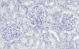 抗ZO-1抗体，克隆号4E14，ZooMAb®兔单克隆抗体 recombinant, expressed in HEK 293 cells