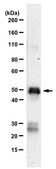 Anti-SARS-CoV-1/2 NP Antibody, clone 1C7C7 ZooMAb® Mouse Monoclonal recombinant, expressed in HEK 293 cells