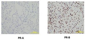 Anti-Progesterone Receptor B Antibody, clone 250/H11 clone 250/H11, from mouse