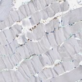 Anti-IQGAP1 antibody produced in rabbit Prestige Antibodies® Powered by Atlas Antibodies, affinity isolated antibody, buffered aqueous glycerol solution