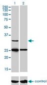 Monoclonal Anti-STAR antibody produced in mouse clone 5F9, purified immunoglobulin, buffered aqueous solution