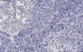 Anti-hnRNP A1 Antibody, clone 9H10 ZooMAb® Mouse Monoclonal recombinant, expressed in HEK 293 cells