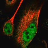 Anti-PAK5 antibody produced in rabbit Prestige Antibodies® Powered by Atlas Antibodies, affinity isolated antibody, buffered aqueous glycerol solution