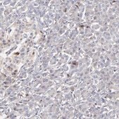 Anti-CALR antibody produced in rabbit Prestige Antibodies® Powered by Atlas Antibodies, affinity isolated antibody, buffered aqueous glycerol solution
