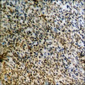 Anti-phospho-Catenin-β (pSer37) antibody produced in rabbit affinity isolated antibody
