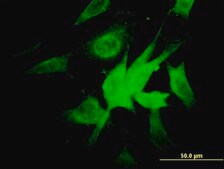 Monoclonal Anti-NDUFA9 antibody produced in mouse clone 3D7, purified immunoglobulin, buffered aqueous solution