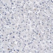 Anti-PCNT antibody produced in rabbit Prestige Antibodies® Powered by Atlas Antibodies, affinity isolated antibody, buffered aqueous glycerol solution, Ab1