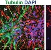 Anti-Tubulin Antibody, beta III isoform, CT, clone TU-20 (Similar to TUJ1) ascites fluid, clone TU-20 (Similar to TUJ1), Chemicon®