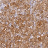 Anti-CBS antibody produced in rabbit Prestige Antibodies® Powered by Atlas Antibodies, affinity isolated antibody, buffered aqueous glycerol solution