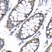 Anti-Hexokinase II antibody produced in rabbit