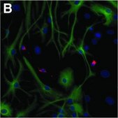 单克隆抗-MAP2 小鼠抗 ascites fluid, clone HM-2