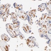 Anti-SPTB antibody produced in rabbit Ab2, Prestige Antibodies® Powered by Atlas Antibodies, affinity isolated antibody, buffered aqueous glycerol solution
