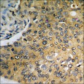 Anti-phospho-PKR (pThr258) antibody produced in rabbit affinity isolated antibody