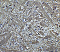 Anti-Bcl-2 (ab1) antibody produced in rabbit affinity isolated antibody, buffered aqueous solution