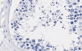 Anti-ATR Antibody, clone 1B15 ZooMAb® Rabbit Monoclonal recombinant, expressed in HEK 293 cells