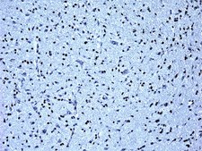 Anti-Olig-2 Antibody from rabbit, purified by affinity chromatography