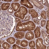 Anti-NDUFAF1 antibody produced in rabbit Prestige Antibodies® Powered by Atlas Antibodies, affinity isolated antibody, buffered aqueous glycerol solution