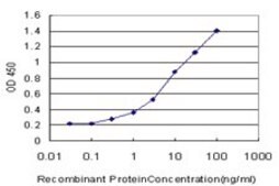 Monoclonal Anti-CPT2 antibody produced in mouse clone 1G7, purified immunoglobulin, buffered aqueous solution