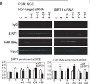 Anti-acetyl-Histone H4 (Lys16) Antibody Upstate®, from rabbit