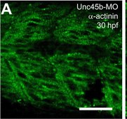 单克隆 抗-α-肌动蛋白（肌小节） 小鼠抗 clone EA-53, ascites fluid