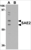 Anti-SAE2 antibody produced in rabbit affinity isolated antibody, buffered aqueous solution