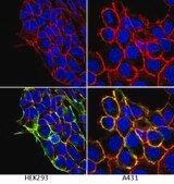 抗-整合素β 1抗体，克隆P5D2 clone P5D2, Chemicon®, from mouse
