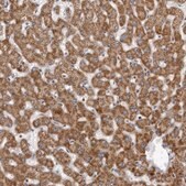 Anti-CPT2 antibody produced in rabbit Prestige Antibodies® Powered by Atlas Antibodies, affinity isolated antibody, buffered aqueous glycerol solution, ab2