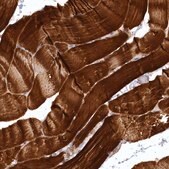 Anti-SYNPO2 antibody produced in rabbit Prestige Antibodies® Powered by Atlas Antibodies, affinity isolated antibody, buffered aqueous glycerol solution