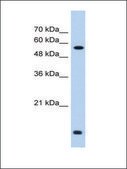 Anti-P4HB (AB2) antibody produced in rabbit affinity isolated antibody