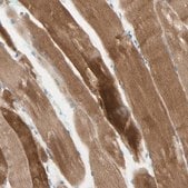 Anti-JPH1 antibody produced in rabbit Prestige Antibodies® Powered by Atlas Antibodies, affinity isolated antibody, buffered aqueous glycerol solution