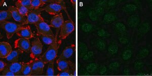 Anti-Notch1 Antibody, clone 1A32 ZooMAb® Rabbit Monoclonal recombinant, expressed in HEK 293 cells