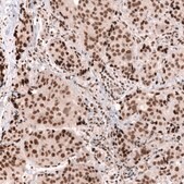 Monoclonal Anti-Smarcb1 Antibody Produced In Mouse Prestige Antibodies® Powered by Atlas Antibodies, clone CL13992, affinity isolated antibody, buffered aqueous glycerol solution
