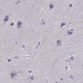 Anti-CALCR antibody produced in rabbit Prestige Antibodies® Powered by Atlas Antibodies, affinity isolated antibody, buffered aqueous glycerol solution