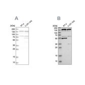Anti-GOLGA2 antibody produced in rabbit Prestige Antibodies® Powered by Atlas Antibodies, affinity isolated antibody, buffered aqueous glycerol solution, Ab2