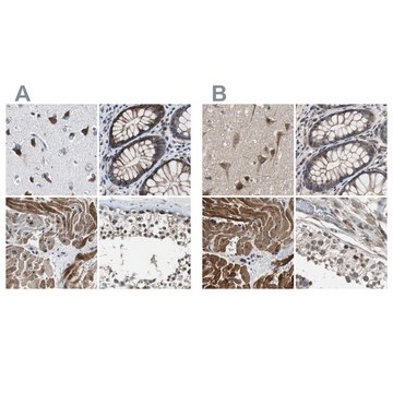 Anti-PITRM1 antibody produced in rabbit Ab2, Prestige Antibodies® Powered by Atlas Antibodies, affinity isolated antibody, buffered aqueous glycerol solution