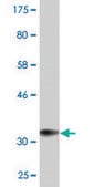 Monoclonal Anti-CTLA4 antibody produced in mouse clone 2F1, purified immunoglobulin, buffered aqueous solution