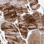 Anti-MYOT antibody produced in rabbit Prestige Antibodies® Powered by Atlas Antibodies, affinity isolated antibody, buffered aqueous glycerol solution