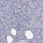 Anti-ANXA6 antibody produced in rabbit Ab1, Prestige Antibodies® Powered by Atlas Antibodies, affinity isolated antibody, buffered aqueous glycerol solution