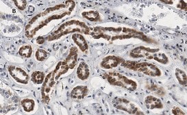 Anti-Smad3 Antibody, clone 1J11, ZooMAb® Rabbit Monoclonal recombinant, expressed in HEK 293 cells