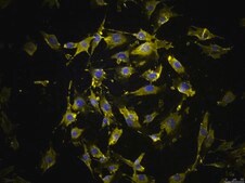 OSUMMER.4 Mouse NRAS-Mutant Melanoma Cell Line