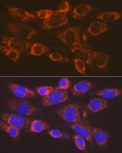 Anti-ARF1 Antibody, clone 0C5B3, Rabbit Monoclonal