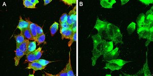 Anti-GABA A Receptor α1 Antibody, clone 3H10 ZooMAb® Rabbit Monoclonal recombinant, expressed in HEK 293 cells