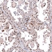 Anti-TFE3 antibody produced in mouse Prestige Antibodies® Powered by Atlas Antibodies, clone CL12810, purified by using Protein A, buffered aqueous glycerol solution